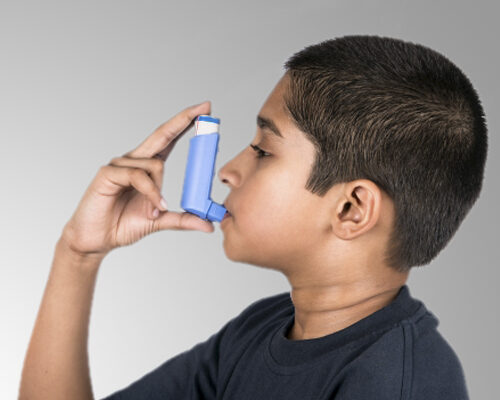 Childhood Asthma