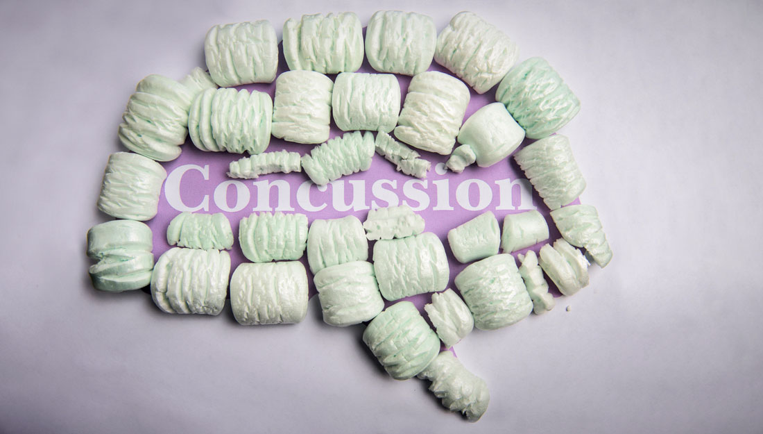 what are concussions