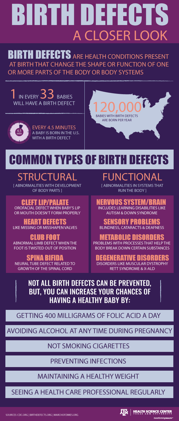 birth defects infographic