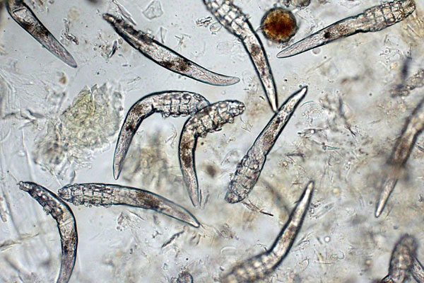 weird body facts - bugs