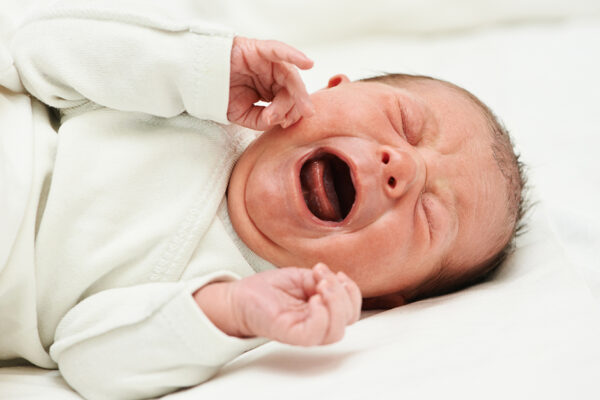 Colic Signs And Symptoms