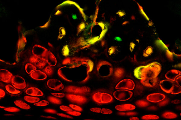 Protein Cells That Could Affect Bone Formation