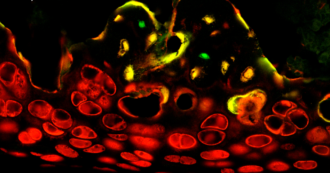 Protein cells that could affect bone formation