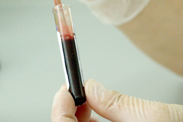 Your Blood Can Say A Lot About Your Health CBC