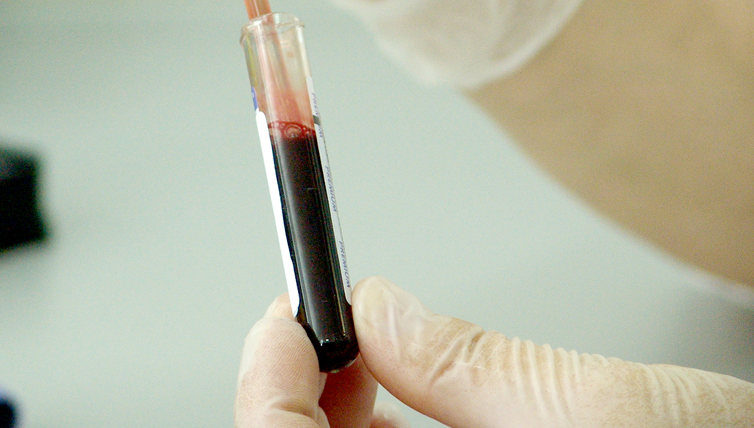 Your blood can say a lot about your health CBC