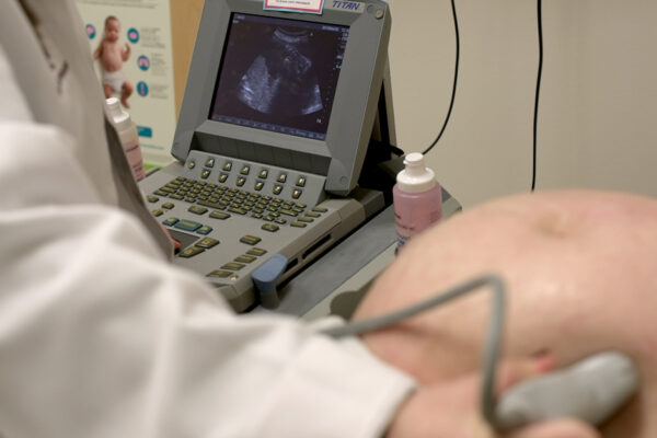 Pregnancy Ultrasound