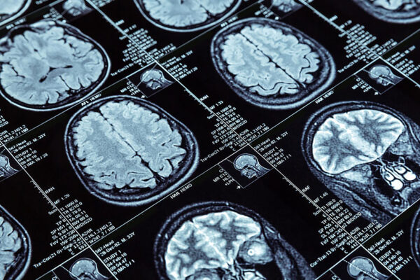 What Is The Difference Between A Psychologist And A Psychiatrist - An Image Of Various Brain Scans