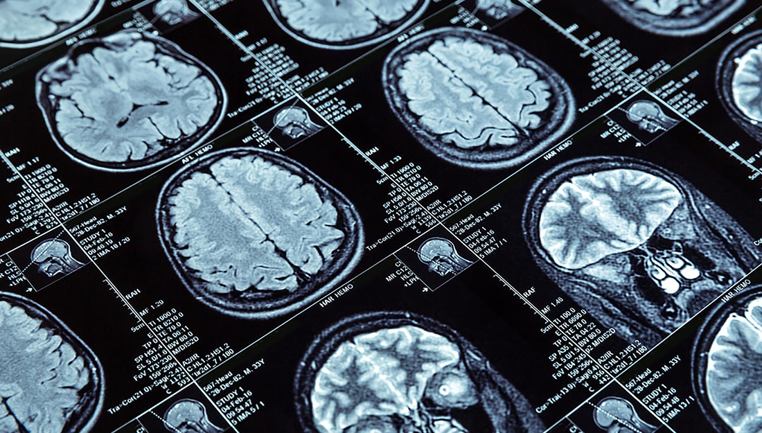 What is the difference between a psychologist and a psychiatrist - an image of various brain scans