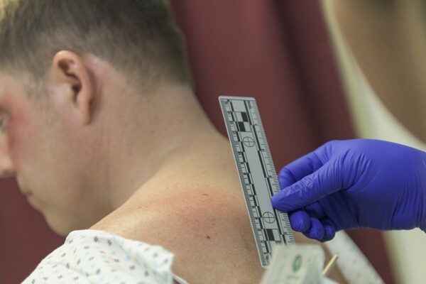 Male Patient Being Checked By A Forensice Nurse