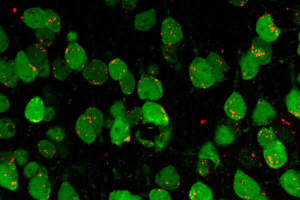 EVs (red Particles) In The Brain