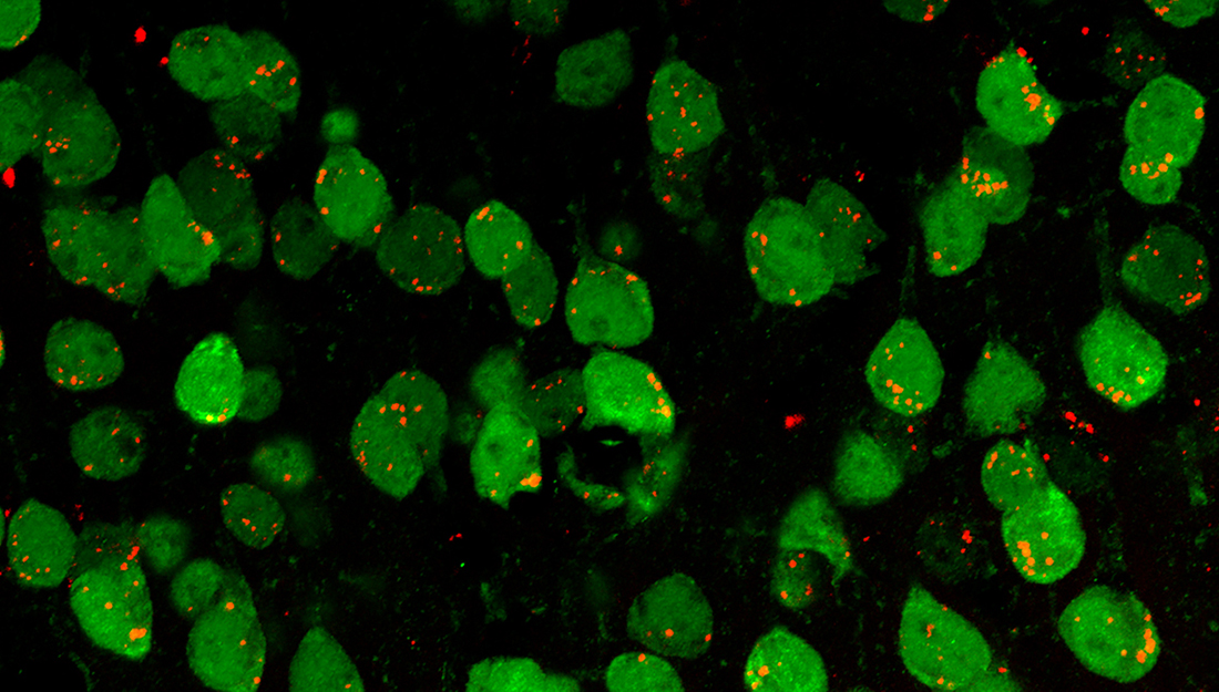 EVs (red particles) in the brain