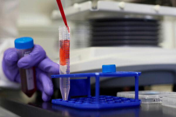 Researcher Works With Liquid Samples In A Laboratory