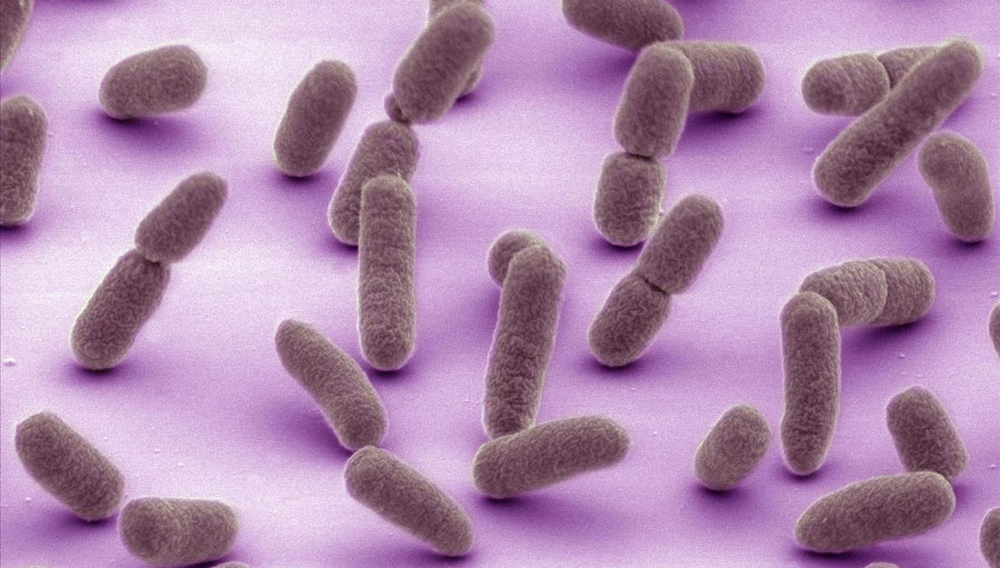 microscopic image of E. coli bacteria