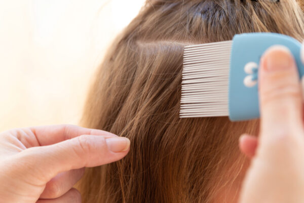 A Pair Of Hands In The Foreground With A Nit Comb In One And A Strand Of Hair In The Other With A Head Of Long, Brown Hair In The Background