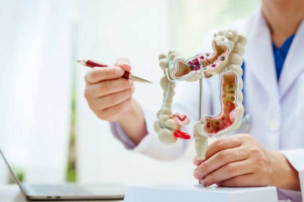 Doctor Pointing A Pen To An Anatomical Model Of The Colorectal System