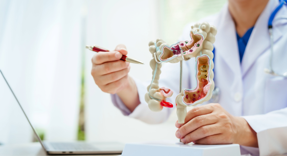 Doctor pointing a pen to an anatomical model of the colorectal system